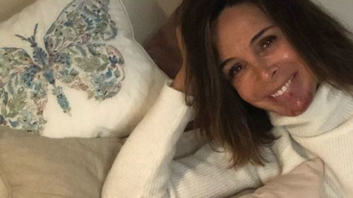 Lydia Bosch anuncia en su instagram que padece cáncer de piel: 